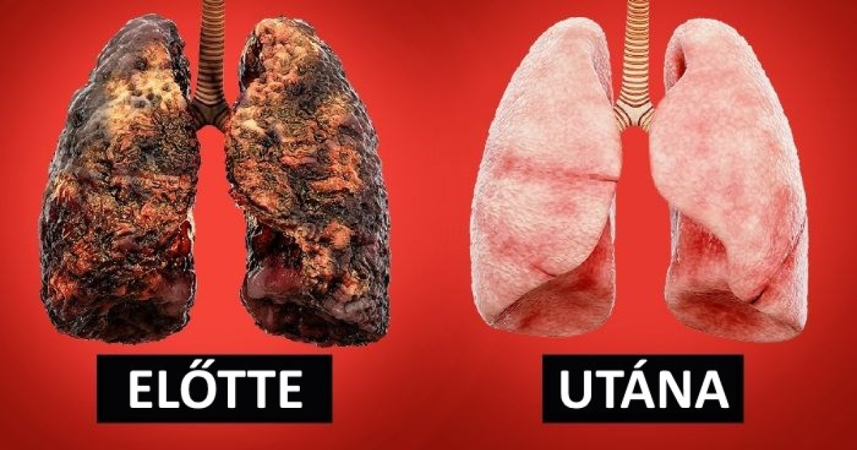A harmadik napon felhagytam a dohányzással